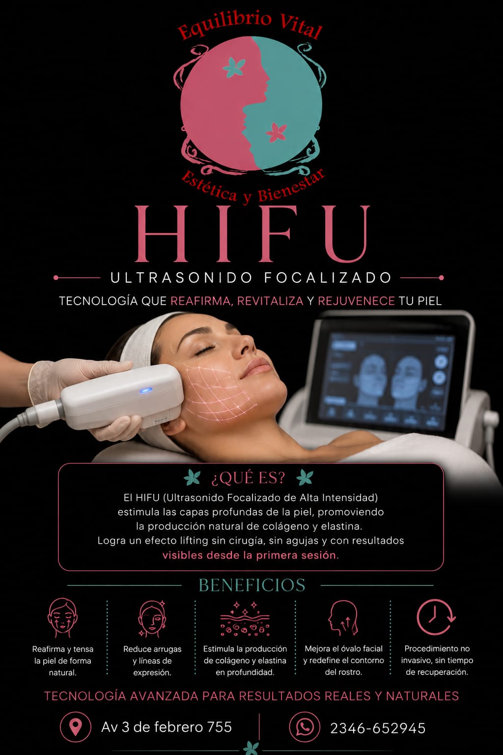HIFU - Ultrasonido Focalizado